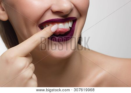 Close-up Portrait Of The Lower Half Of A Woman's Face With A Malicious Grin. He Picks A Long Fingern
