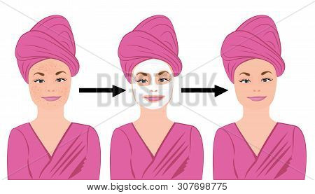 Acne Skin Disease  Before And After Treatment Vector Illustration
