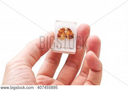 Doctor Hold And Show Up Paraffin Embedded Tissue Blocks Of Cancer On Isolated White Background.