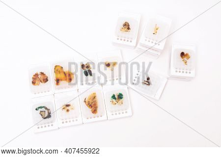Paraffin Embedded Tissue Blocks Of Cancer On Isolated White Background.