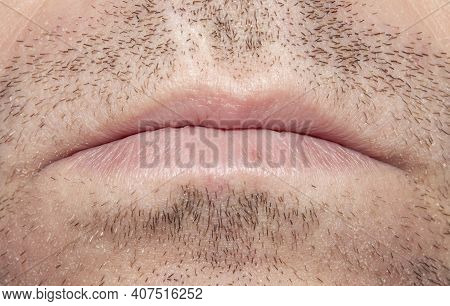 Unshaven Stubble On A Man's Face.part Of An Unshaven Male Face.photo Of Male Bristles.