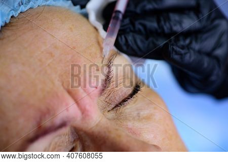 Closeup Woman Injection. Age Changes. Cosmetology Treatment. Procedure Augmentation. Syringe Female 