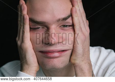 Teenager, Young Guy Stretched Out His Face With His Hands, Headache, Anxiety, Frustration, Bipolar D