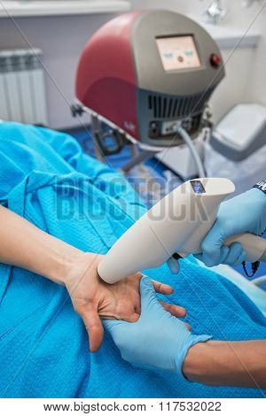 Procedure against hyperhidrosis