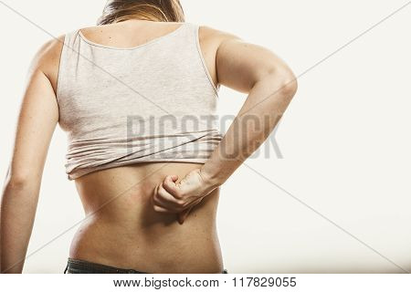 Human Scratching Itchy Back Skin. Rash.