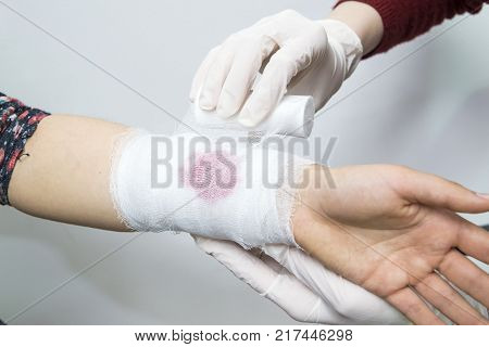 Bandaging a bleeding injury on the forearm using a white bandage