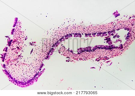 Cell Microscopic- Pyloric Division Stomach