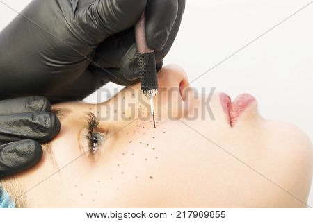 Permanent microblasting tattooing freckles to a woman in a beauty salon