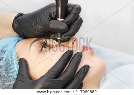 Permanent microblasting tattooing freckles to a woman in a beauty salon