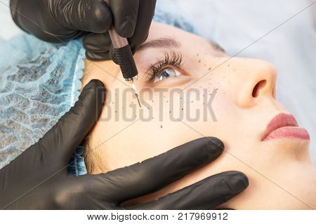 Permanent microblasting tattooing freckles to a woman in a beauty salon