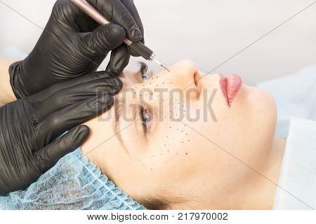 Permanent microblasting tattooing freckles to a woman in a beauty salon