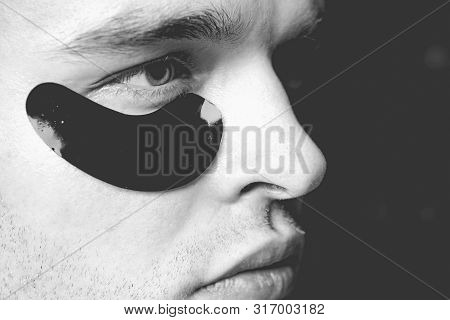 Man Face With Flakes Under The Eyes. Mans Flakes. Patches Under Close Eyes For Man. Close-up Of A Yo