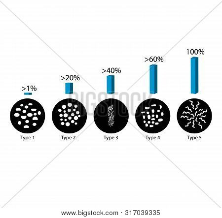 The Probability Of Detecting Breast Cancer With Different Types Of Microcalcinates. Mammography. Inf