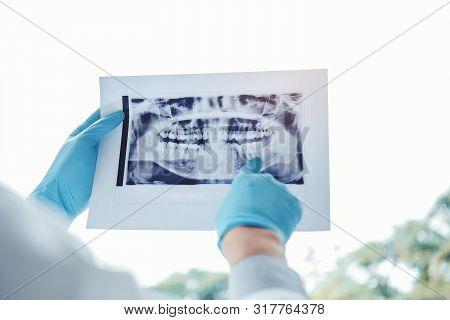 Dentist Consulting With Patient Presenting Results On Dental X-ray Film About The Problem Of The Pat