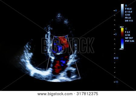 Colourful Image Of Modern Ultrasound Monitor. Ultrasonography Machine. High Technology Medical And H