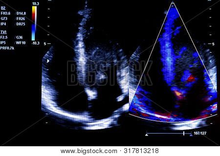 Colourful Image Of Modern Ultrasound Monitor. Ultrasonography Machine. High Technology Medical And H