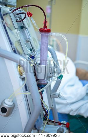 Dialysis Machine Is Working. Acting As A Substitute For The Kidneys To Drive Waste From The Body.