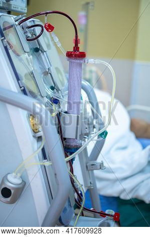 Dialysis Machine Is Working. Acting As A Substitute For The Kidneys To Drive Waste From The Body.