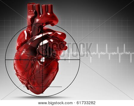 Human Heart Under Attack