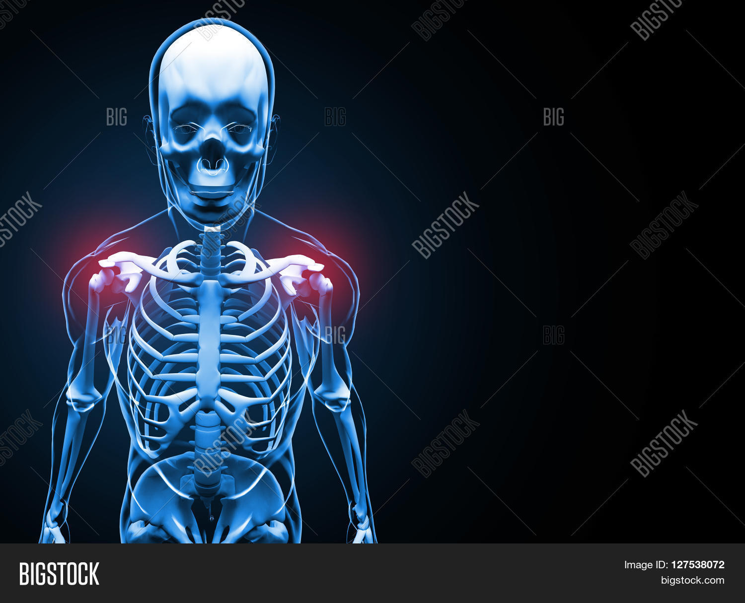 Xray Shoulder Pain Image & Photo (Free Trial) Bigstock