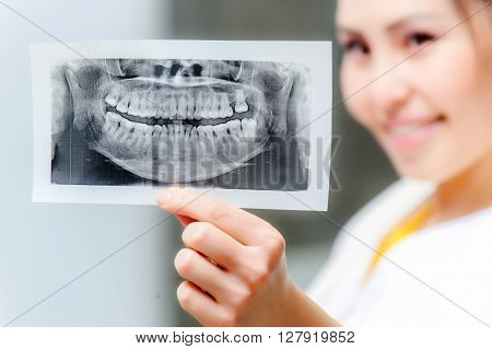 Dentist looking at x-ray picture in the office