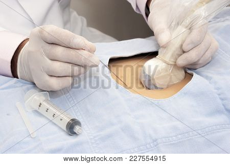 Doctor And Patient