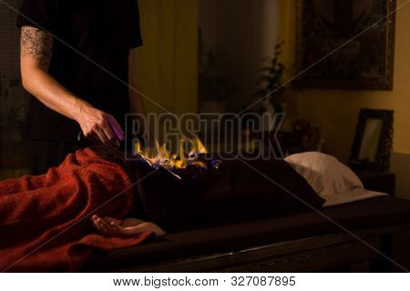 Chinese Fire Massage - Huo Liao Therapy. Traditional Chinese Medicine, Fire Treatment And Bodycare C