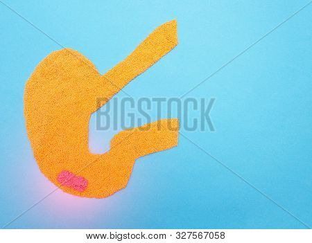 Stomach On A Blue Background. The Concept Of Diseases Of The Stomach And Gastrointestinal Tract, Gas