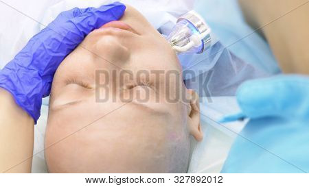 Close-up. Microneedle Rf Lifting Procedure. Hardware Cosmetology. Beautician Conducts A Facial Rejuv
