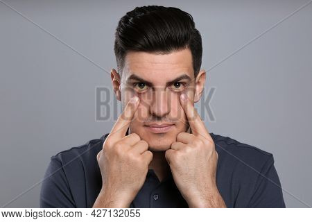 Man Checking His Health Condition On Grey Background. Yellow Eyes As Symptom Of Problems With Liver
