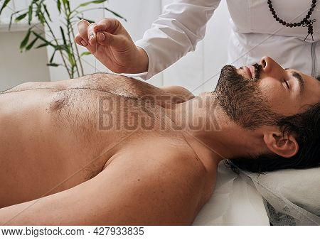 Acupuncturist Inserts Acupuncture Needles At Special Points On Mans Body Meridians. Acupuncture Need