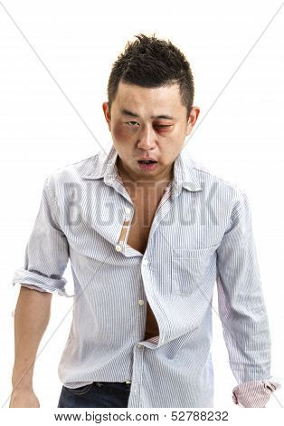 Wounded Man