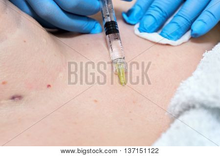 Anti-age injection therapy. Wrinkles reduction in clinic