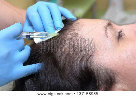 Procedure of anti hair loss injection in clinic