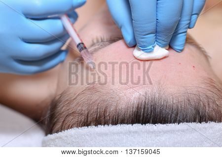 Anti-age injection therapy. Mimic wrinkles reduction in clinic