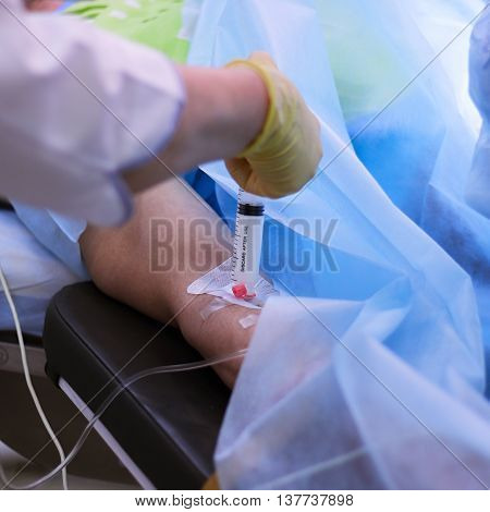 Dr. gloved hand makes injection into the catheter