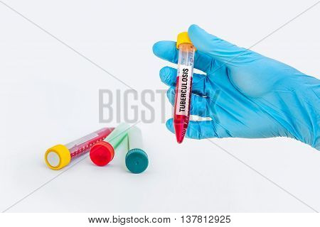 Test-tube With Blood Sample For Tuberculosis Test