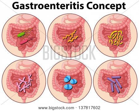 Diagram showing gastroenteritis concept illustration
