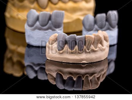 Artificial Tooth