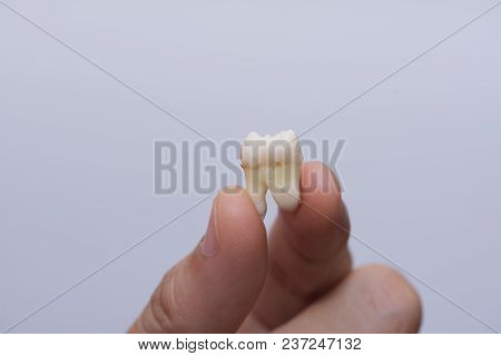 A Person Using Fingers Holding Extracted Wisdom Tooth