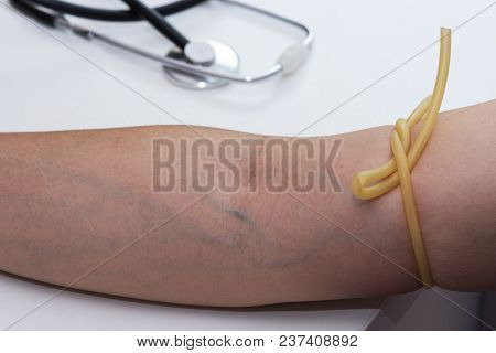 A Tourniquet Binding The Arm Form Blood Drawn