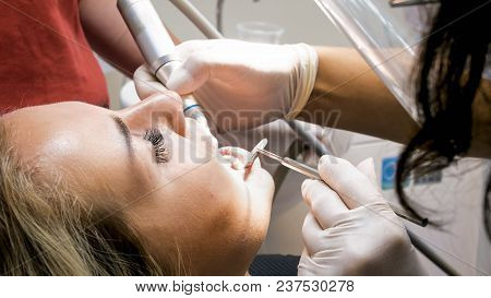 Closeup Image Of Woman Opens Mouth While Dentist Clening Teeth Plaque