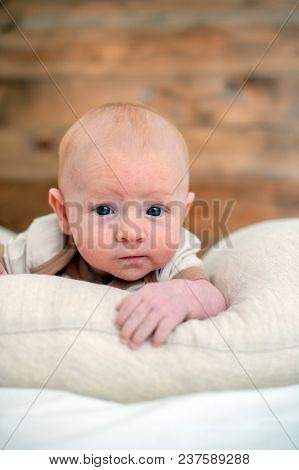 Allergies, Atopic Dermatitis On The Face Of A Baby