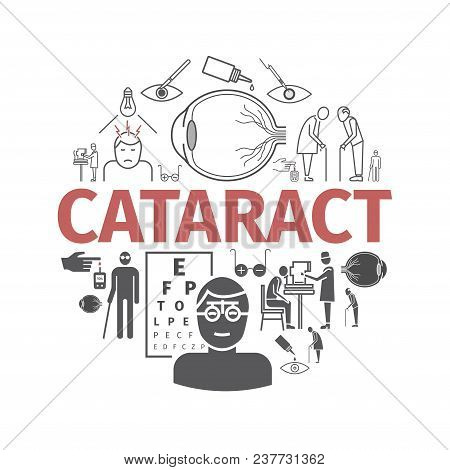 Cataract. Symptoms, Treatment. Icons Set Signs For Web Graphics