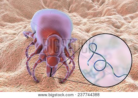 Lyme Disease Bacteria, Borrelia Burgdorferi, Transmitted By Ixodes Tick, 3d Illustration