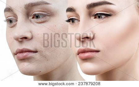Comparison Portrait Of Young Woman With And Without Makeup. Close-up Shot.