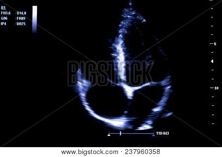 Colourful Image Of Modern Ultrasound Monitor. Ultrasonography Machine. High Technology Medical And H