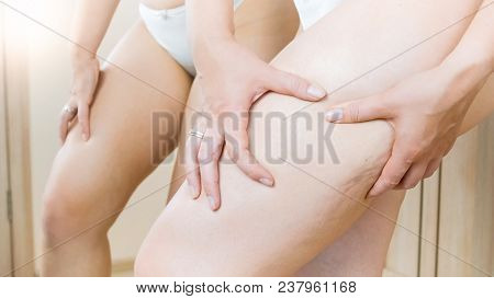Closeup Photo Of Young Woman In Panties With Cellulite