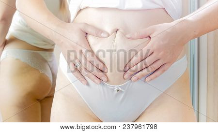 Closeup Image Of Young Woman With Stretchmarks On Belly