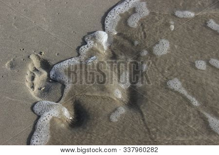 Comparison Of The Foot Pattern Of A Healthy Person And A Person With Flat Feet. Footprints Of Differ